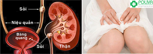 Nguy cơ bị nhiễm trùng đường tiểu và tiết niệu nếu quan hệ quá nhiều