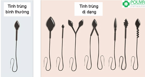 Thường xuyên sử dụng thuốc kháng sinh khiến tinh trùng yếu, bị dị dạng