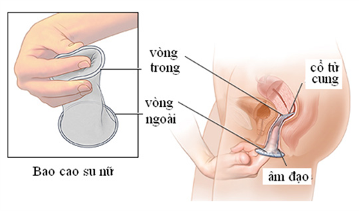 Khám phá những điều ít biết về cao su cho nữ