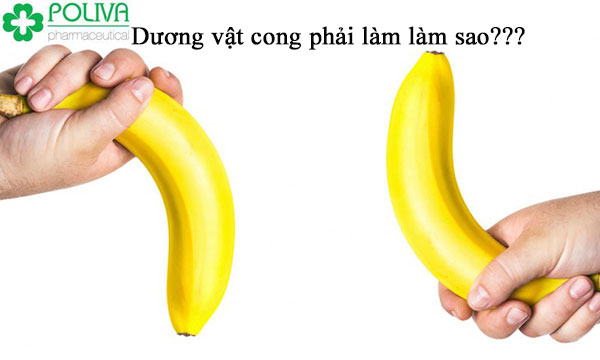 dương vật cong