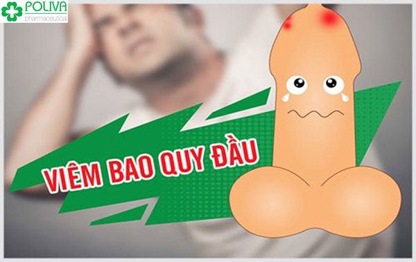 Bệnh viêm bao quy đầu - nỗi ác mộng của cánh đàn ông