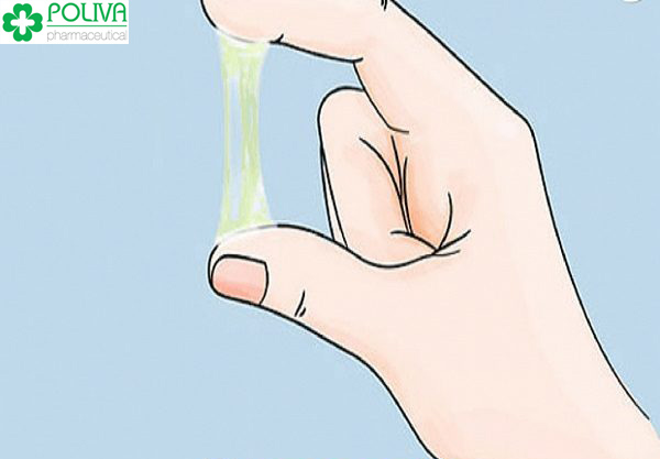 Cẩn thận với việc huyết trắng có màu vàng