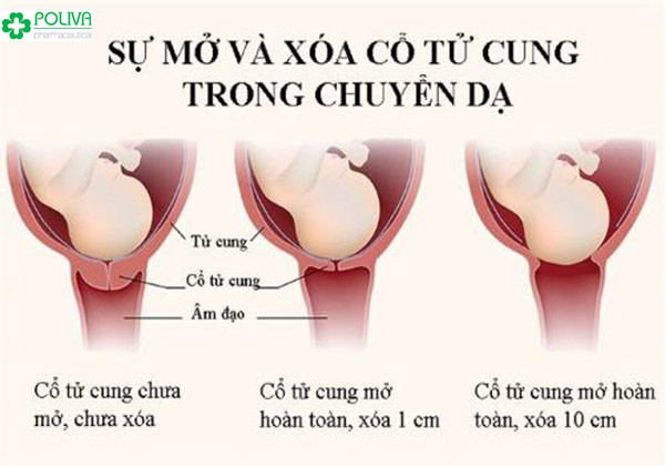 Quy trình cổ tử cung mở khi mẹ bầu chuyển dạ