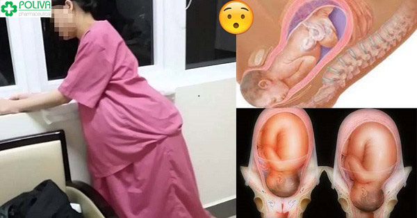 Đi bộ giúp cổ tử cung mở nhanh hơn