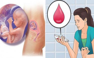 Cách phân biệt máu báo thai, máu kinh nguyệt và máu báo sảy thai