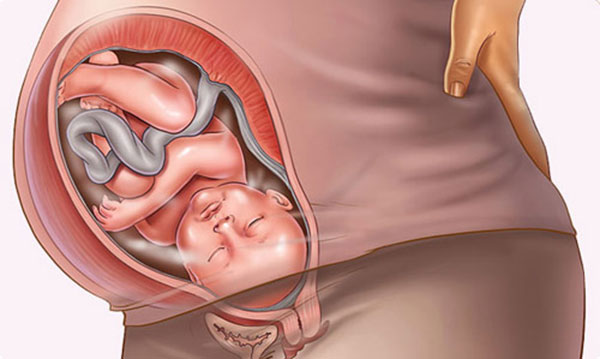 Vỡ nước ối là dấu hiệu rõ nét nhất của việc sắp sinh