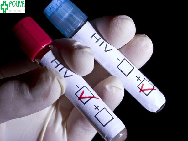 Xét nghiệm máu nhiều giai đoạn để biết chính xác mắc HIV hay không