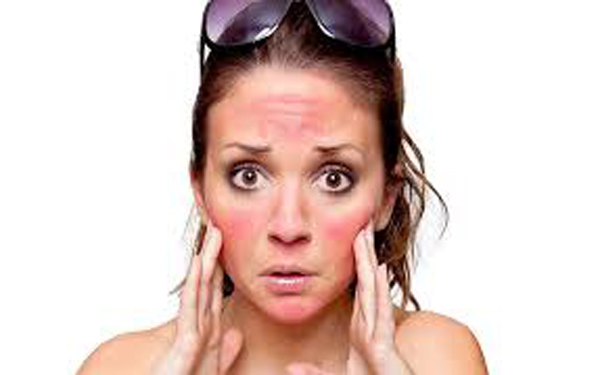 Bốc hoả nóng mặt – bệnh bốc hoả lên đầu cách điều trị dứt điểm