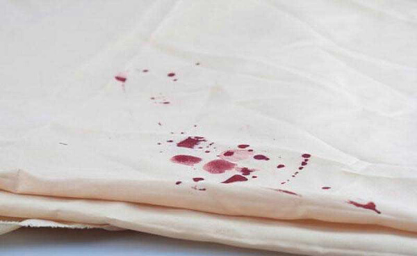 Vết máu khô trên giường là vết bẩn rất khó làm sạch theo cách thông thường
